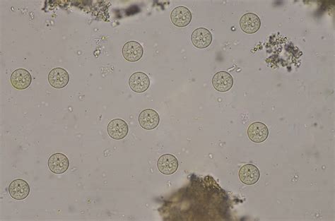 Entamoeba Histolytica Cyst Parasitology Porn Sex Picture