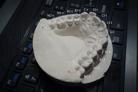 1.4 how to make your own false teeth for $5. Can You Fix Your Own Teeth with 3D Printed Retainers? | Make: