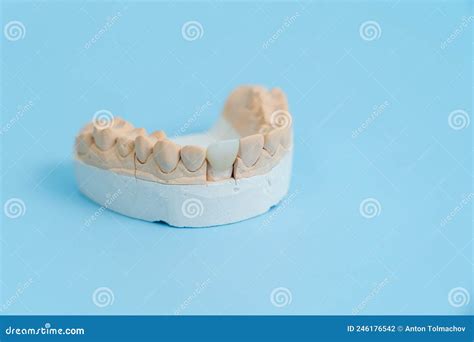 Model Of Teeth And Gums On Blue Background Stock Photo Image Of Help