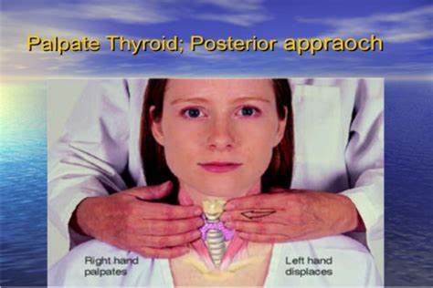 Thyroid Hypothyroidism And Hyperthyroidism Flashcards Quizlet