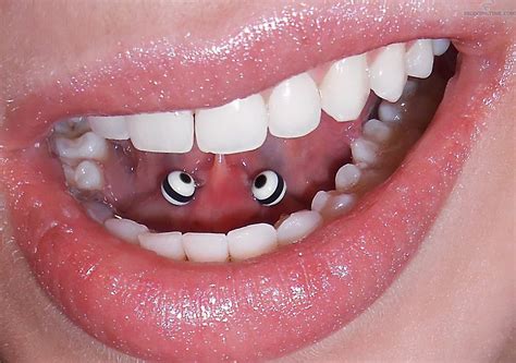 What Your Dentist Wants You To Know About Your Oral Piercings Bodyjewelry