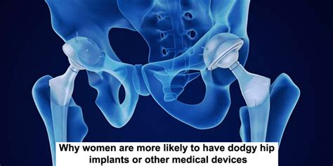 Why Women Are More Likely To Have Dodgy Hip Implants Or Other Medical Devices Tagg