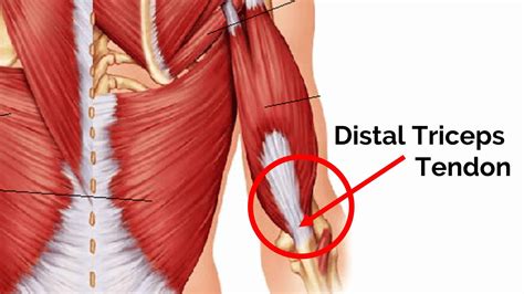 Distal Triceps Tendon Min Barbell Rehab