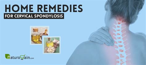6 Best Home Remedies For Cervical Spondylosis That Gives Fast Relief