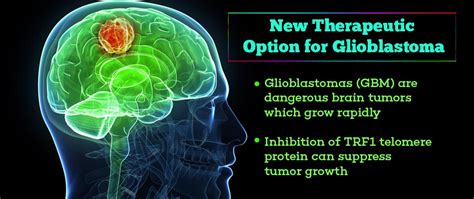 Novel Targeted Therapy Against Glioblastoma