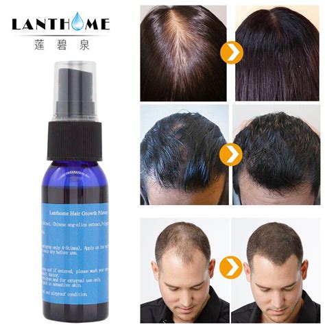 Lanthome Alopecia Areata Hair Growth Serum Oil For Stop Hair Loss