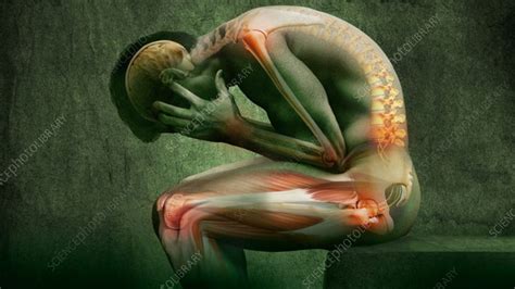 Man With Joint Pain Animation Stock Video Clip K0082754 Science
