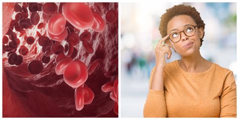 Diferencia Entre Sangre Venosa Y Sangre Arterial Mejor Con Salud