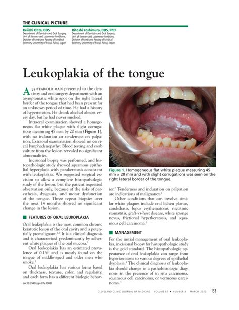 Leukoplakia Of The Tongue Cleveland Clinic Journal Of Medicine