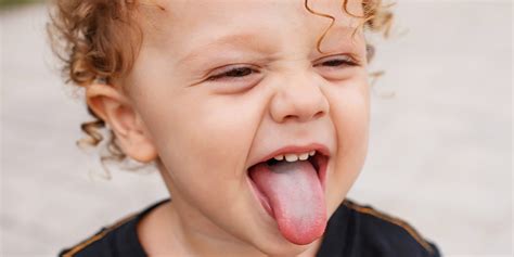 Does Your Child Have Yellowish Tongue Know Symptoms Causes And