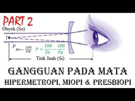Gangguan Pada Mata Part 2 Contoh Soal Miopi Dan Hipermetropi YouTube