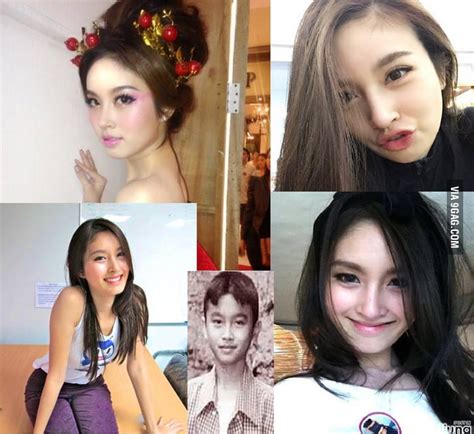 Thai Model Nong Poy Underwent Surgery At The Age Of And Is Now The