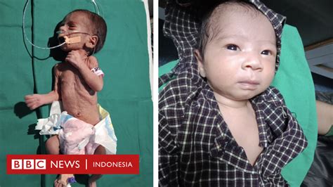 Ditemukan Dikubur Hidup Hidup Bayi Prematur Di India Mampu Bertahan