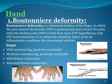 Deformities Of Human Body Pps