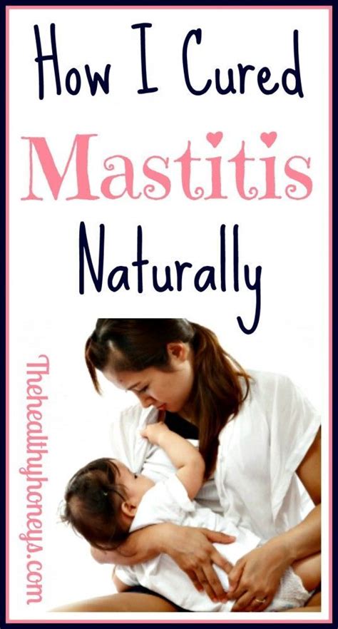 How To Treat Mastitis Naturally Breastfeeding Mastitis Breastfeeding Baby Care