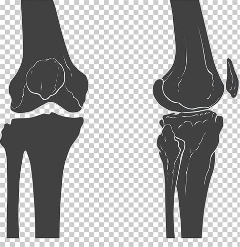 Knee Joint Clipart 10 Free Cliparts Download Images On Clipground 2023
