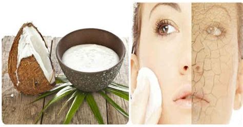 Best Natural Remedies For Dry Skin