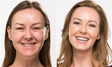 Look Ten Years Younger With Whiter Teeth