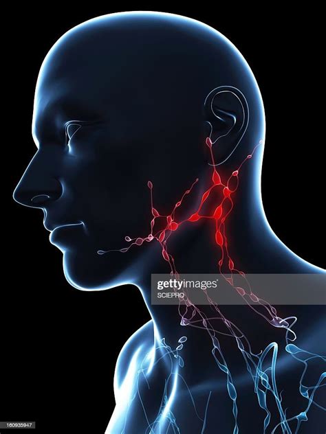 Inflamed Lymph Nodes Conceptual Artwork High Res Vector Graphic Getty