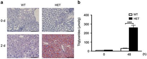 Christiane filangieri was born on august 21, 1978 in würzburg, bavaria, germany as christiane filangieri de candida gonzaga. A20 HET associates with maladaptive hepatic macrosteatosis ...