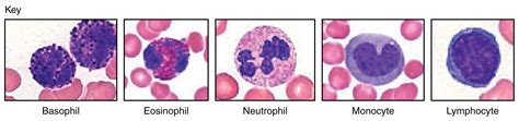 High Level Of White Blood Cells In Semenfertilitypedia