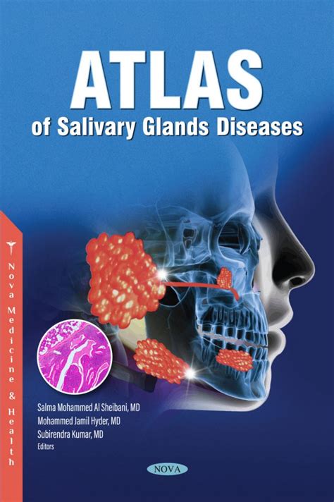 Atlas Of Salivary Glands Diseases Nova Science Publishers