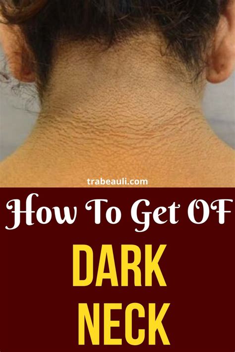 Do white spots on teeth have a particular medical name? How to Get Rid of Dark Neck: 13 Natural Home Remedies ...