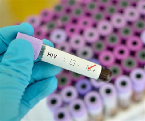 New Hiv Medication May Require Only Once A Year Dose