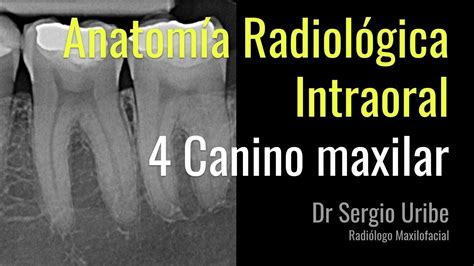 Anatomia Radiografica Intraoral 4 Youtube