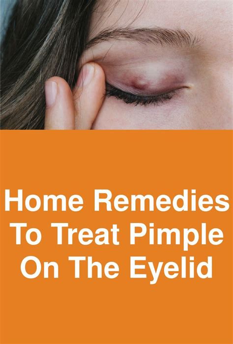 Home Remedies To Treat Pimple On The Eyelid Pimples Pimple On Eyelid