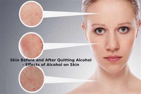 Skin Before And After Quitting Alcohol Effects Of Alcohol On Skin