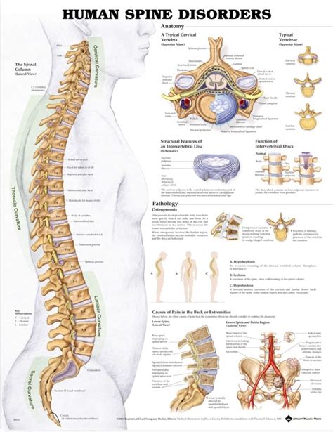 Human Spine Disorders Anatomical Canada Clinic Supply