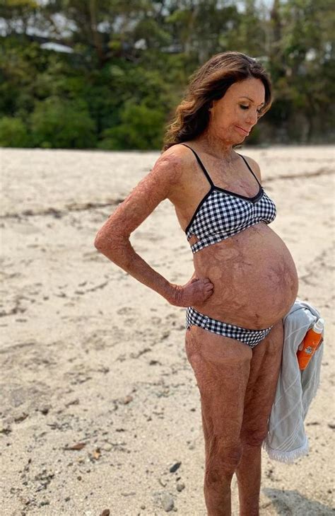 Turia Pitt Shows Off Pregnancy Bump In Stunning Bikini Beach Photo The Courier Mail