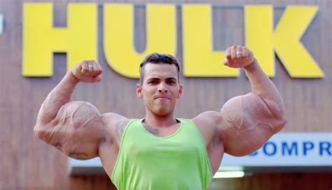 Bodybuilders Risk Their Lives By Injecting Their Muscles With Oil Video