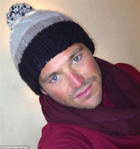 Red Nose Day Was Last Month Mark Wright Suffers From Sunburn Nowmynews