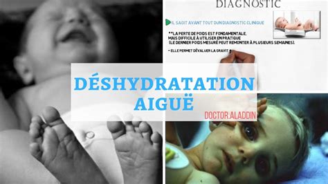 deshydration aiguë pédiatrie causes symptÔmes diagnostique traitement et pathologie