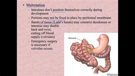unit 14 3 digestive system disorders youtube