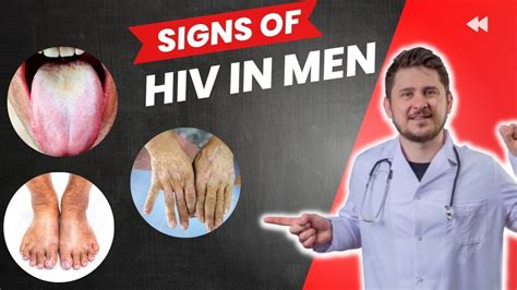 Signs Of Hiv In Men Hiv Symptoms In Men Early Signs Youtube