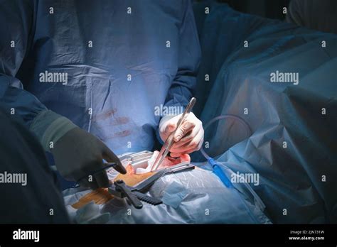 Closeup Of Doctors Hands Operating A Patient Conducting Open Cut