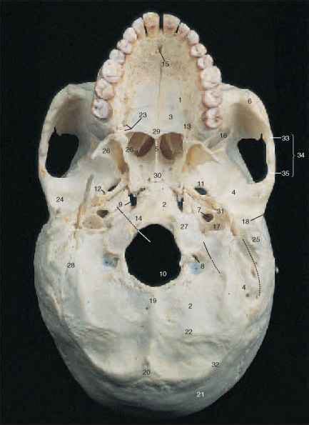 Skull Base Inferior View Temporal Bone 78 Steps Health