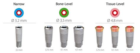 Marcas y tipos de implantes dentales en España Clínica Dental Oliver Coll