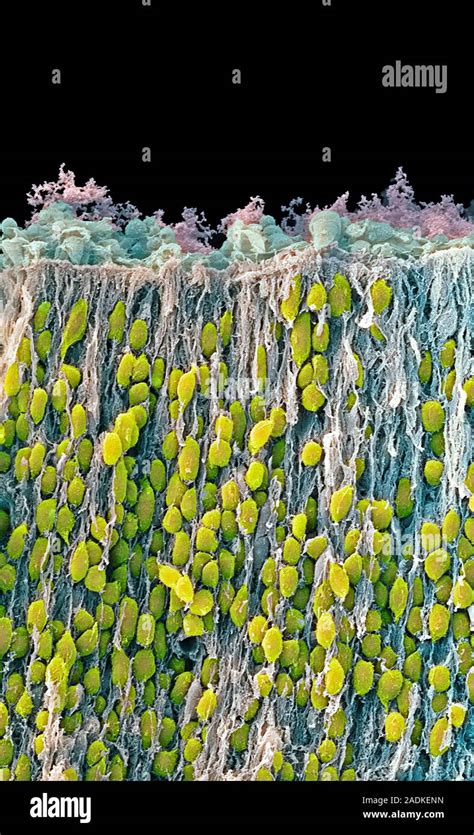 Las Células Del Cerebro Fetal Color Análisis Micrografía De Electrones