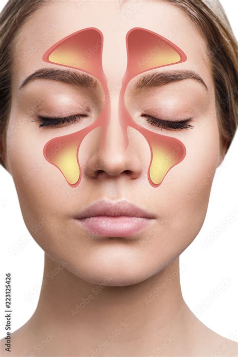 Female Face Shows Nasal Sinus With Cold Over White Background Stock