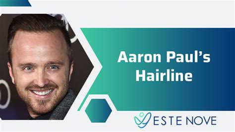 Aaron Pauls Hairline Estenove Turkey