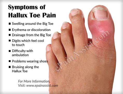 Broken Big Toe Joint Symptoms Broken Toe Treatment Symptoms Recovery