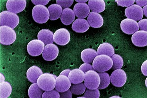 Researchers Uncover Camouflage Strategy Of Multi Resistant Bacteria