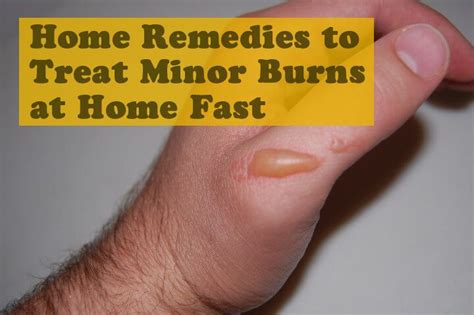 Minor Burns Also Known As First Degree Burns Damage Only The