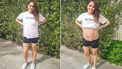 aussie mother applauded for showing reality of postpartum body after having quadruplets newshub