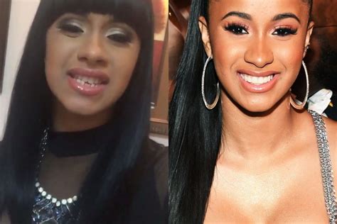 Do All Celebrities Have Veneers Your Personal Guide On Hollywood Smile