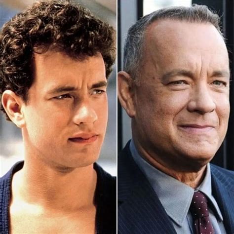 Tom Hanks Plastic Surgery Photos Before After Surgery